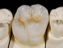 A quoi servent les caractéristiques de la céramique zircone ?