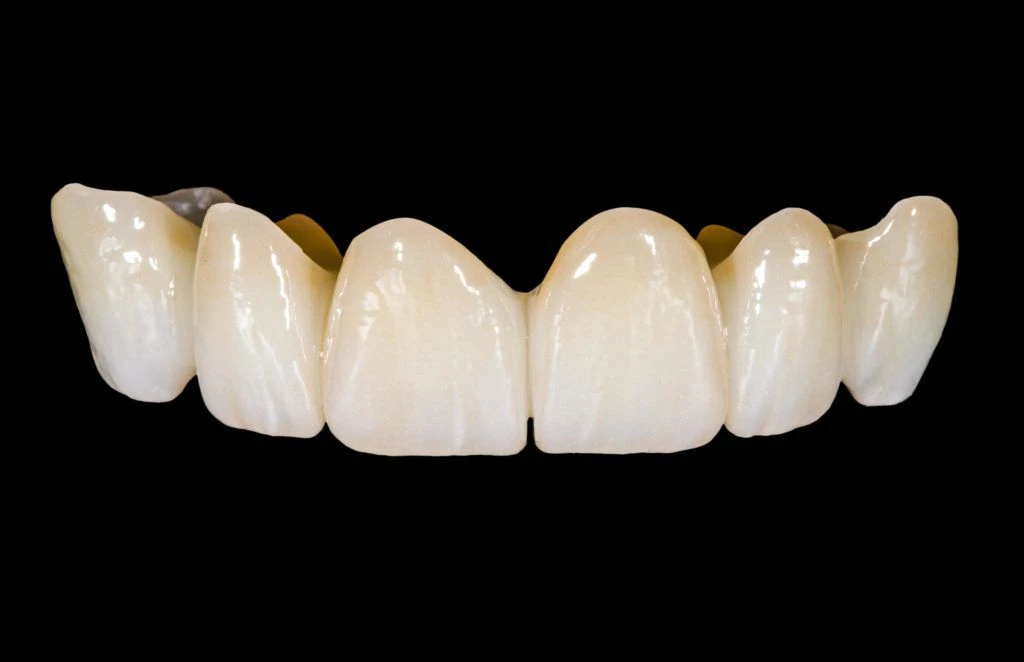 Application de céramique de zircone